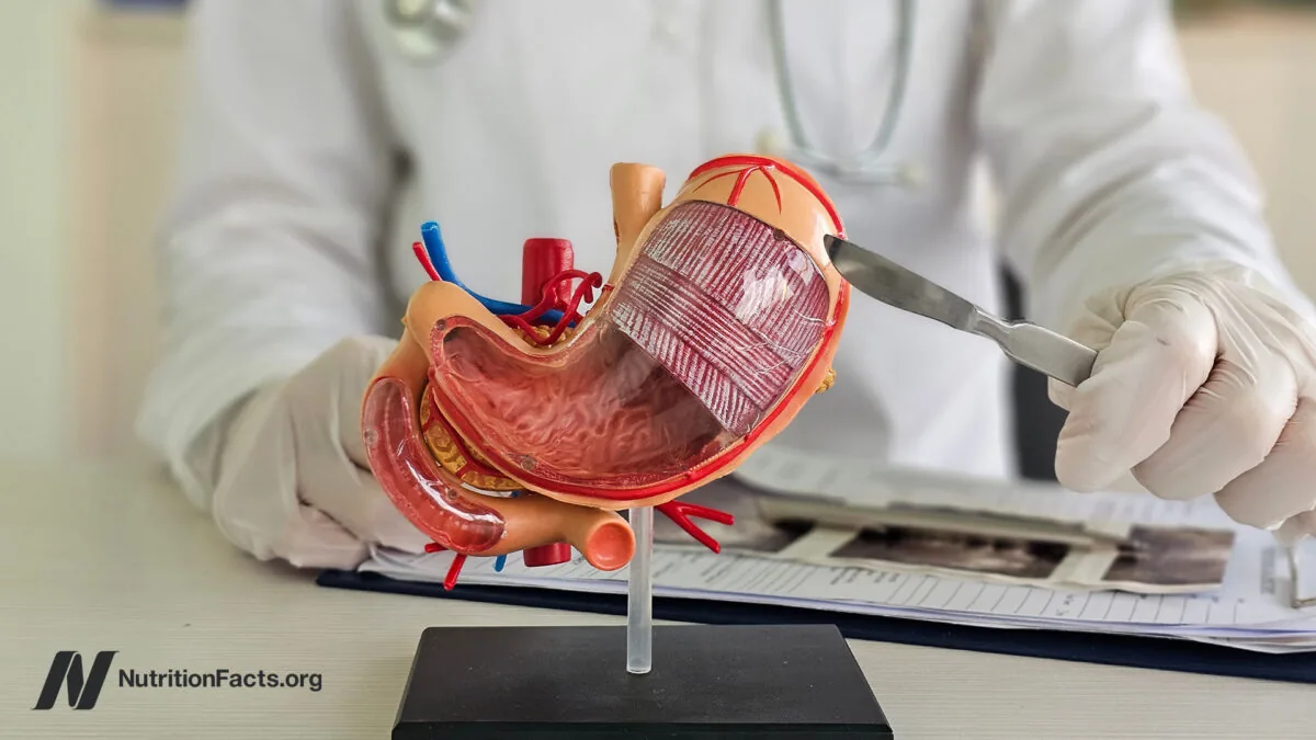 Unveiled Downsides of Weight Loss Surgery